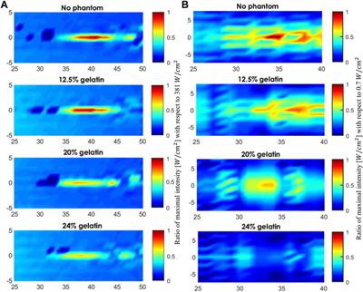 High-resolution acoustic mapping of tunable gelatin-based phantoms for ultrasound tissue characterization